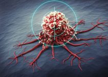 Nghiên cứu mới về thuốc phóng xạ “săn và tiêu diệt” tế bào ung thư